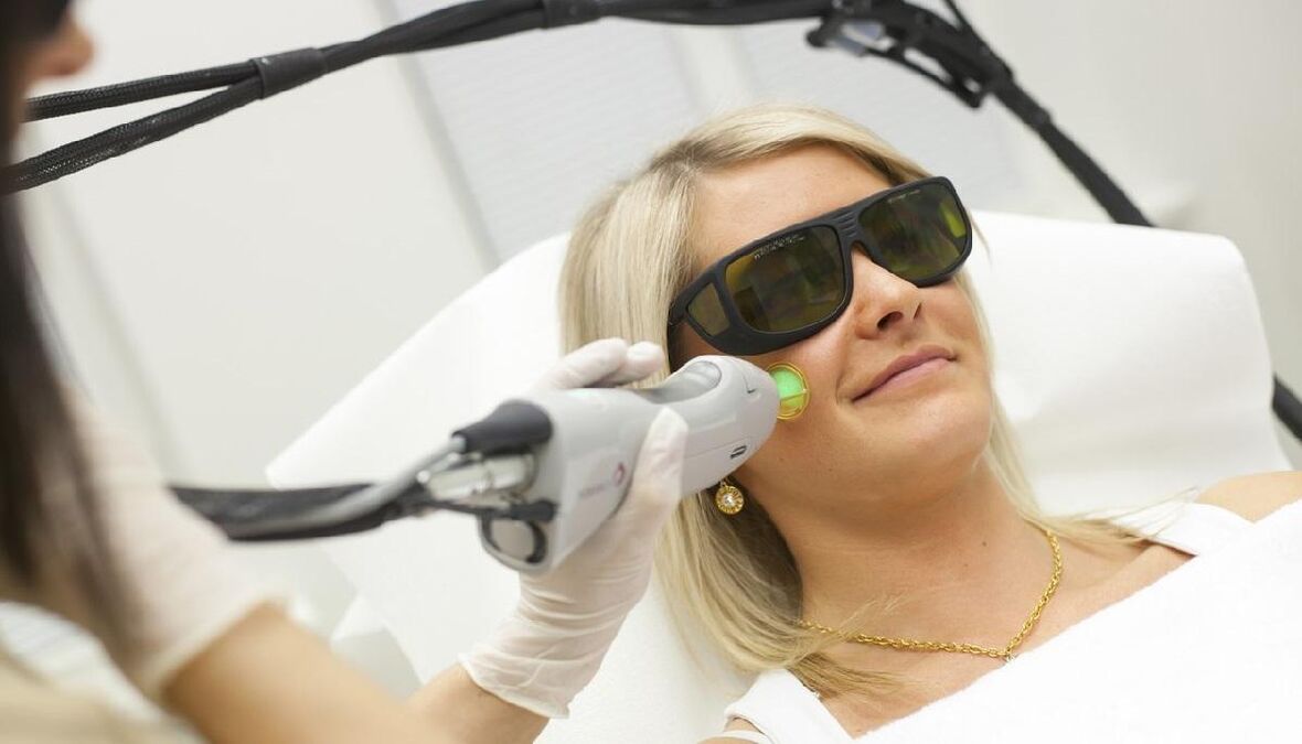 Întinerirea laserului