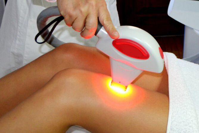 Înlăturarea părului cu laser