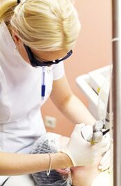 Un medic efectuează o procedură de fototermoliză