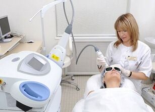 avantaje și dezavantaje ale întineririi fracționale a pielii faciale cu laser